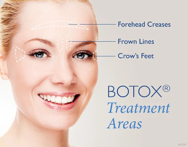BOTOX.jpg