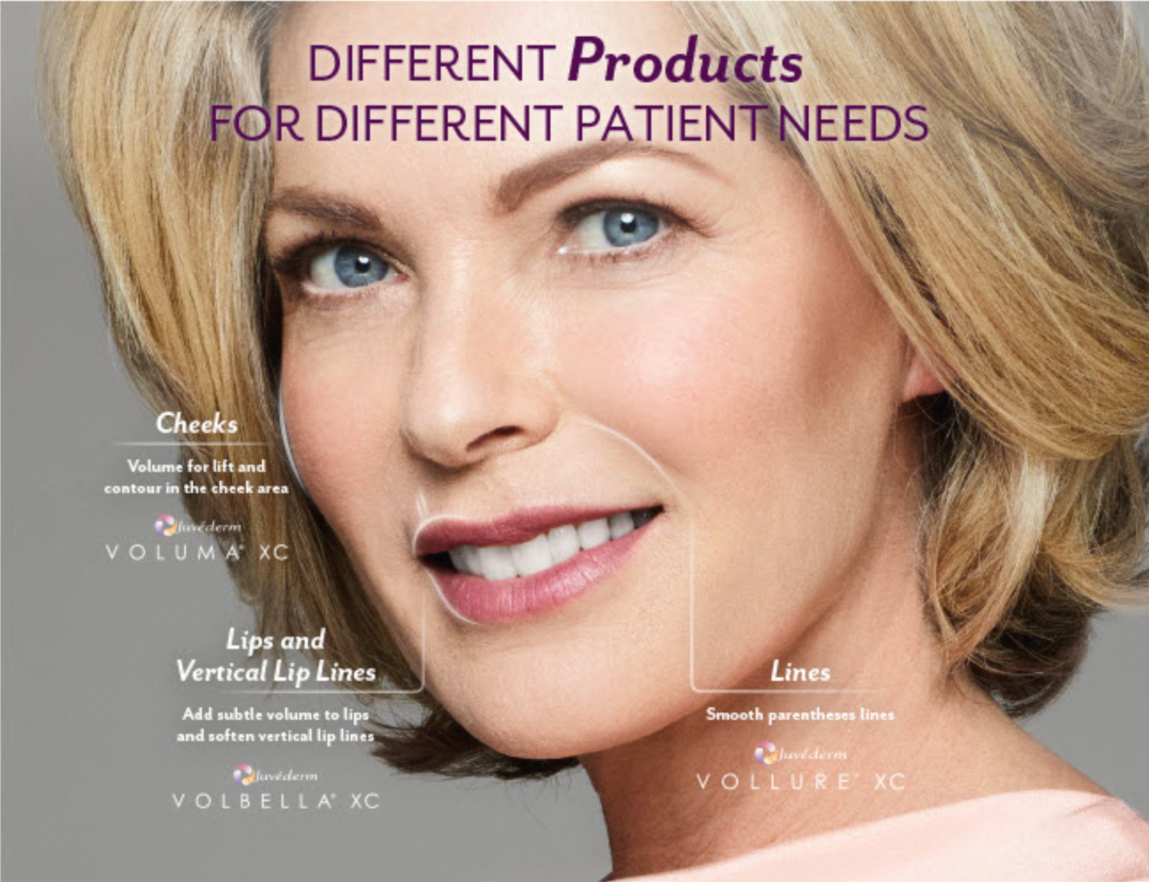 juvederm-areas.png