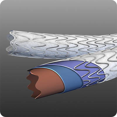 Medical Stent