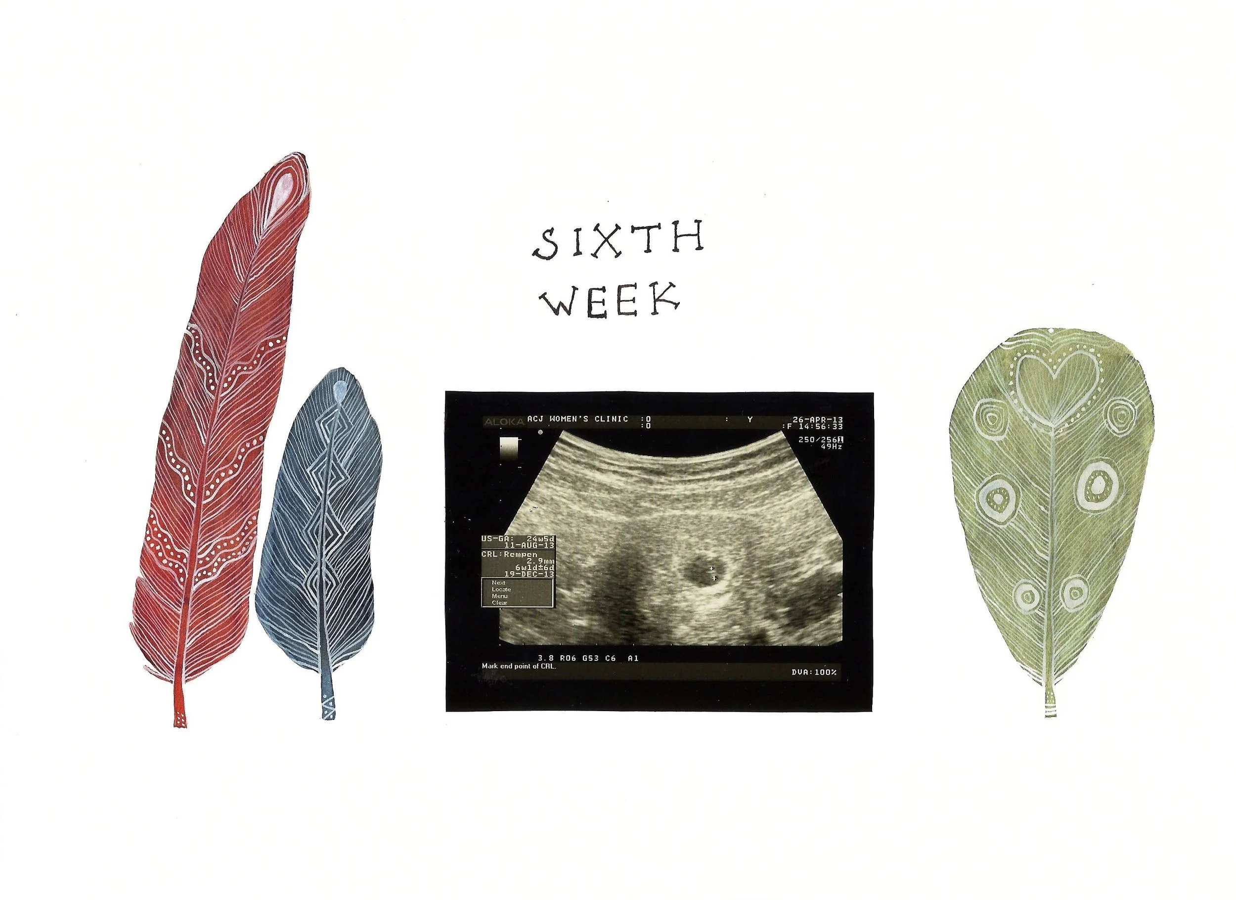 sixth week ultrasound scan
