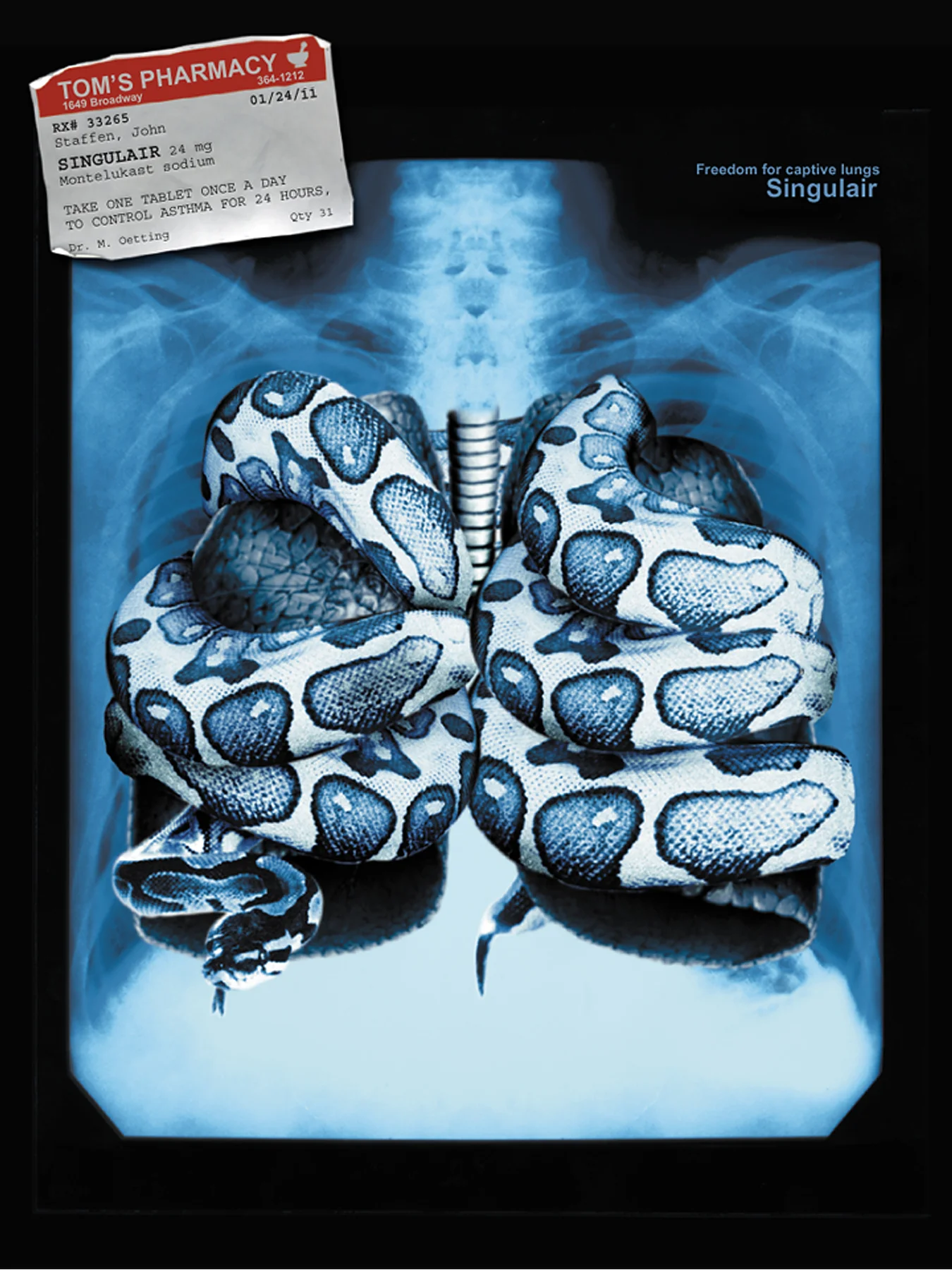 x-ray.jpg