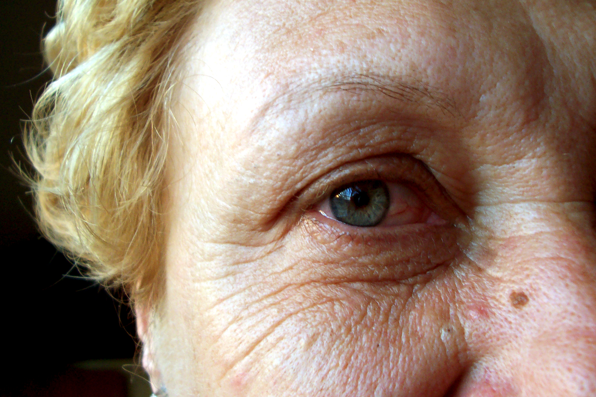 In your 50s, 60s and 70s, deep furrows, heavy bags, and crepe-y skin make the eyes look smaller and more tired.