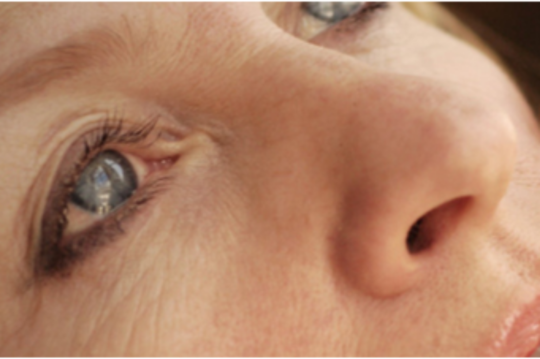 In your 30s and 40s, crows feet, dark circles, and loose skin appear.