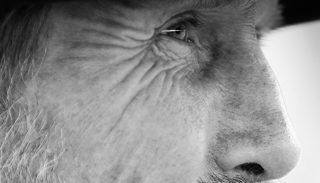 Facial aging can detract from a man's sense of youthful vitality.