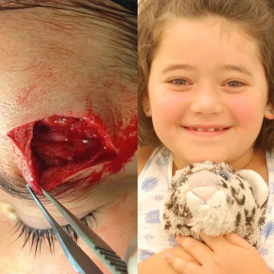 "I'm all better." 7 year old facial laceration patient