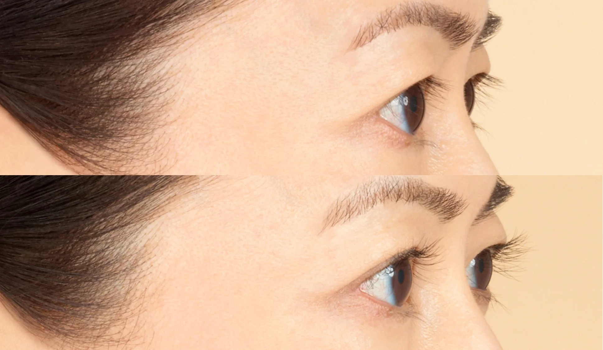 Before and after Latisse, image credit Allergan