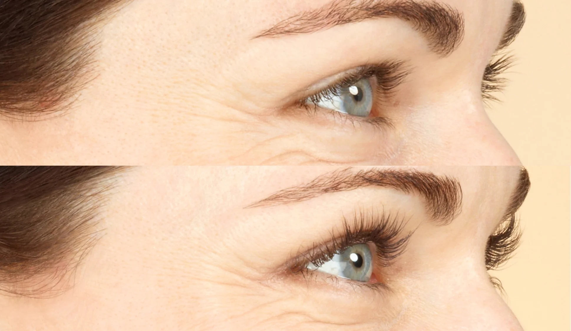 Before and after Latisse, image credit Allergan