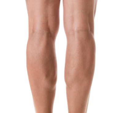 Dr. Devgan offers guidance on ankle fat deposits in Zwivel article