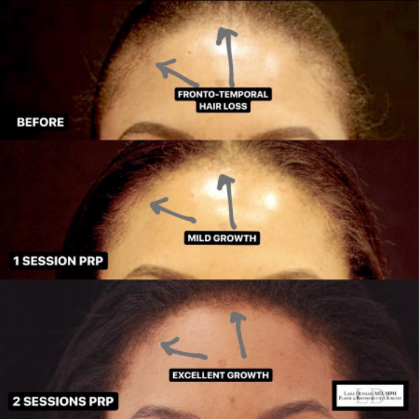 best+plastic+surgeon+for+hair+loss.png