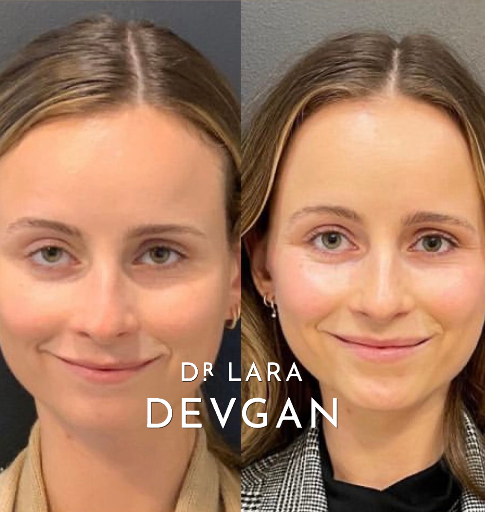 Devgan_SP_B&A_FavoriteCases_WM_Photo1_1.0.png