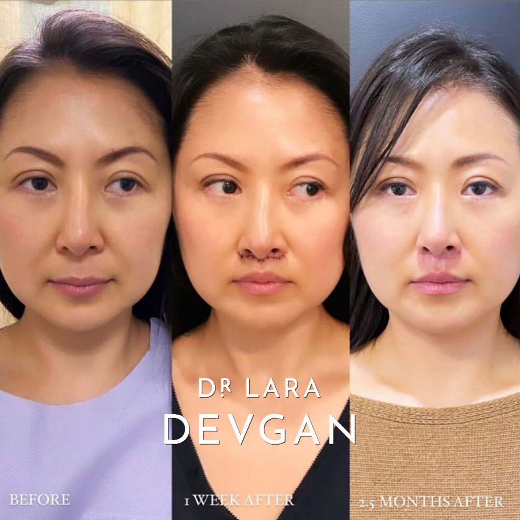 Devgan_SP_B&A_FavoriteCases_WM_Photo2_1.0.png