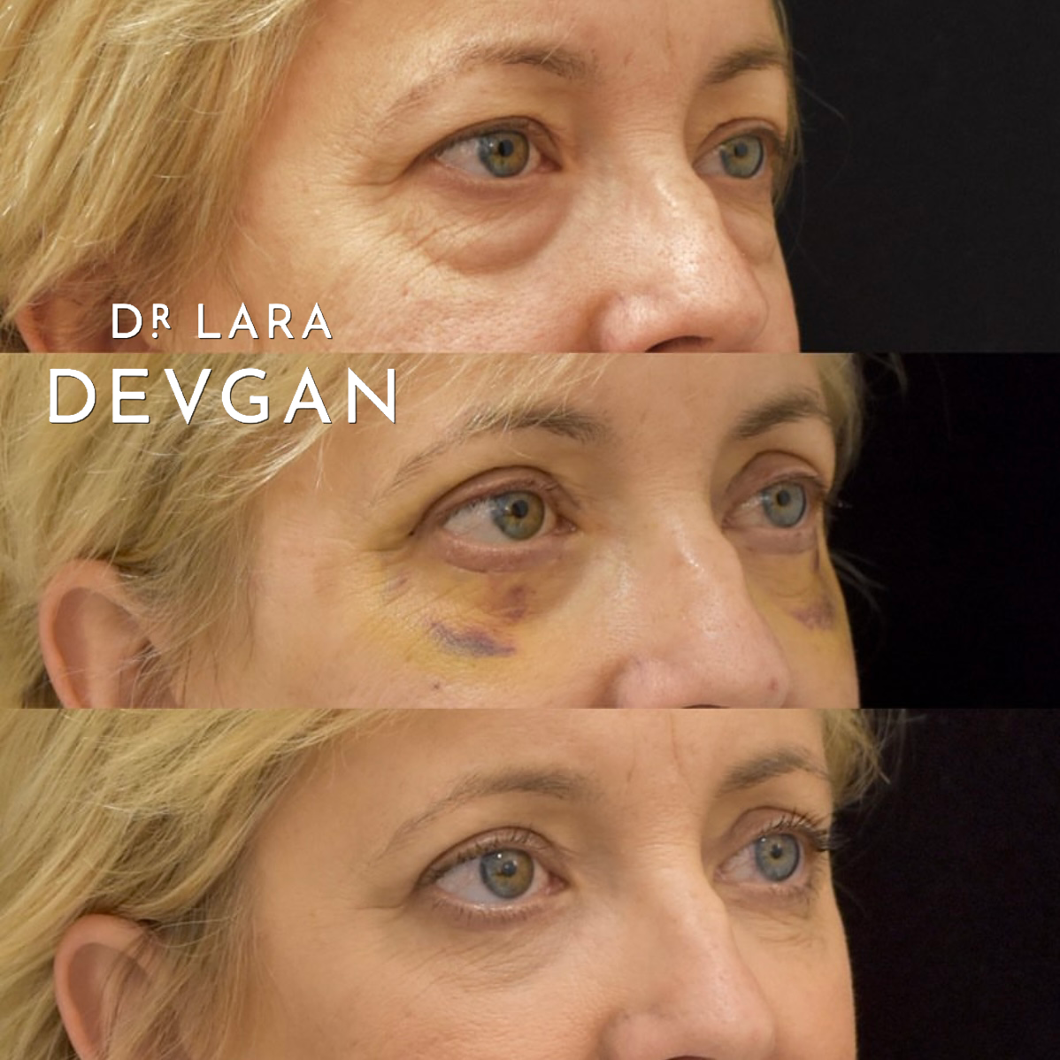 Devgan_SP_B&A_FavoriteCases_WM_Photo4_1.0.png