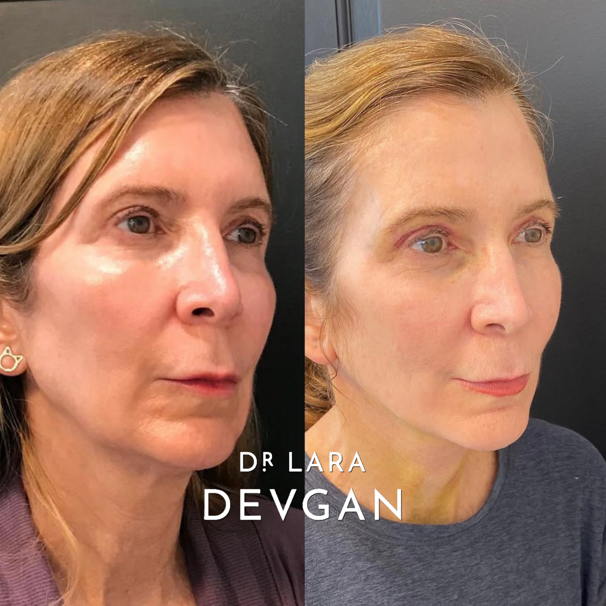 Devgan_SP_B&A_FavoriteCases_WM_Photo8_1.0.png