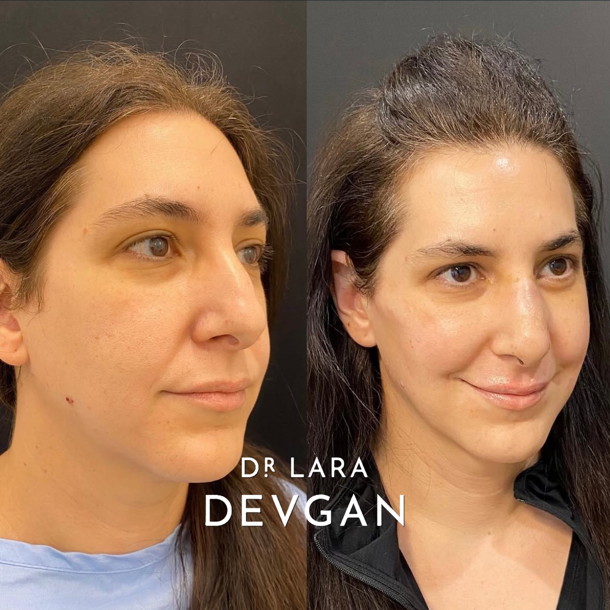 Devgan_SP_B&A_FavoriteCases_WM_Photo11_1.0.png