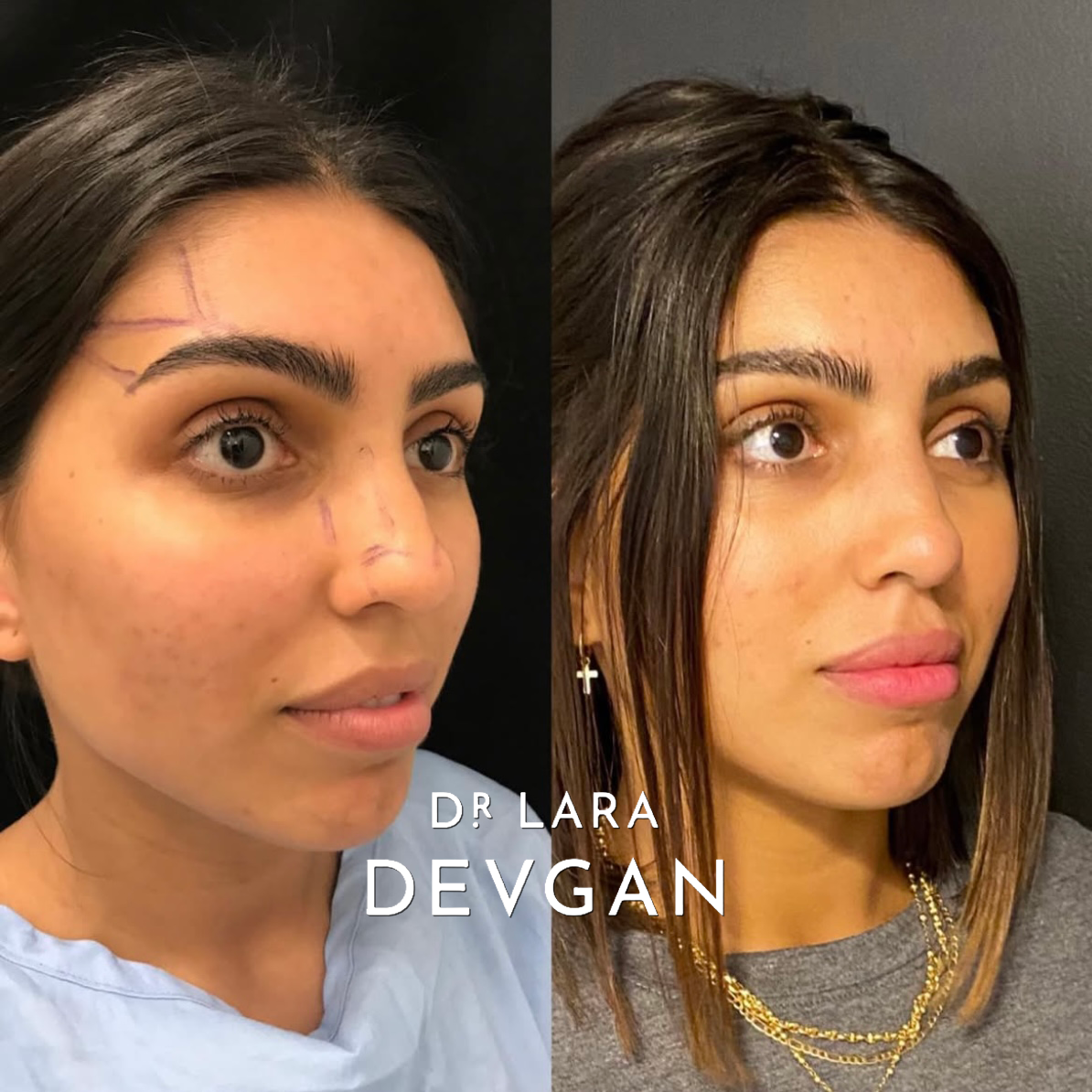 Devgan_SP_B&A_FavoriteCases_WM_Photo13_1.0.png