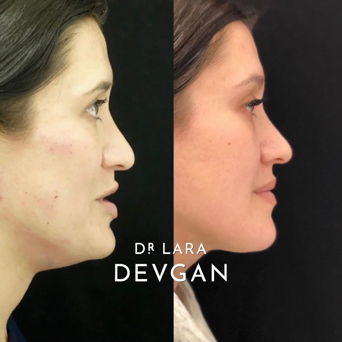 Devgan_SP_B&A_FavoriteCases_WM_Photo20_1.0.png