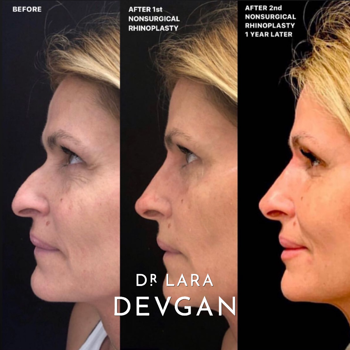 Devgan_SP_B&A_FavoriteCases_WM_Photo22_1.0.png