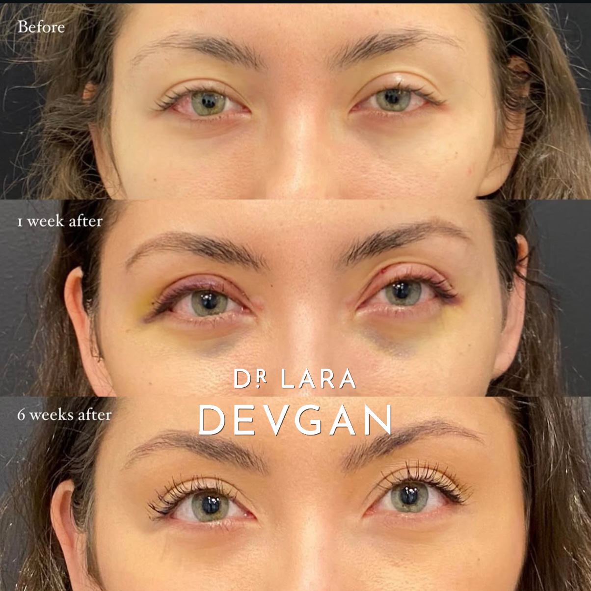 Devgan_SP_B&A_FavoriteCases_WM_Photo24_1.0.png