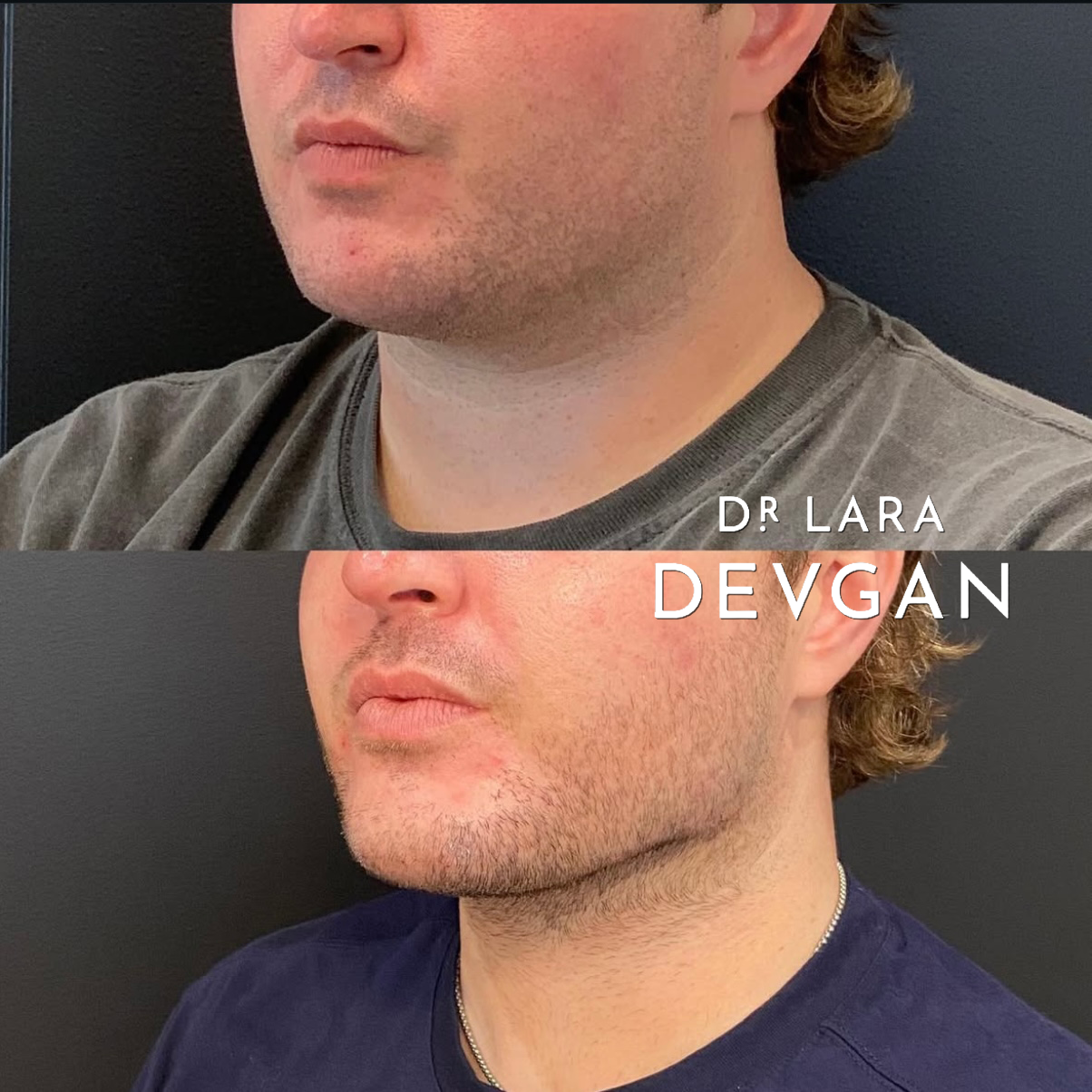 Devgan_SP_B&A_FavoriteCases_WM_Photo27_1.0.png