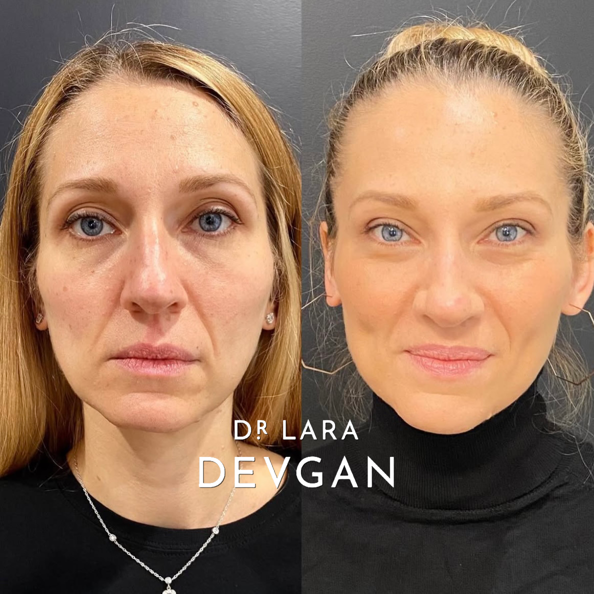 Devgan_SP_B&A_FavoriteCases_WM_Photo29_1.0.png