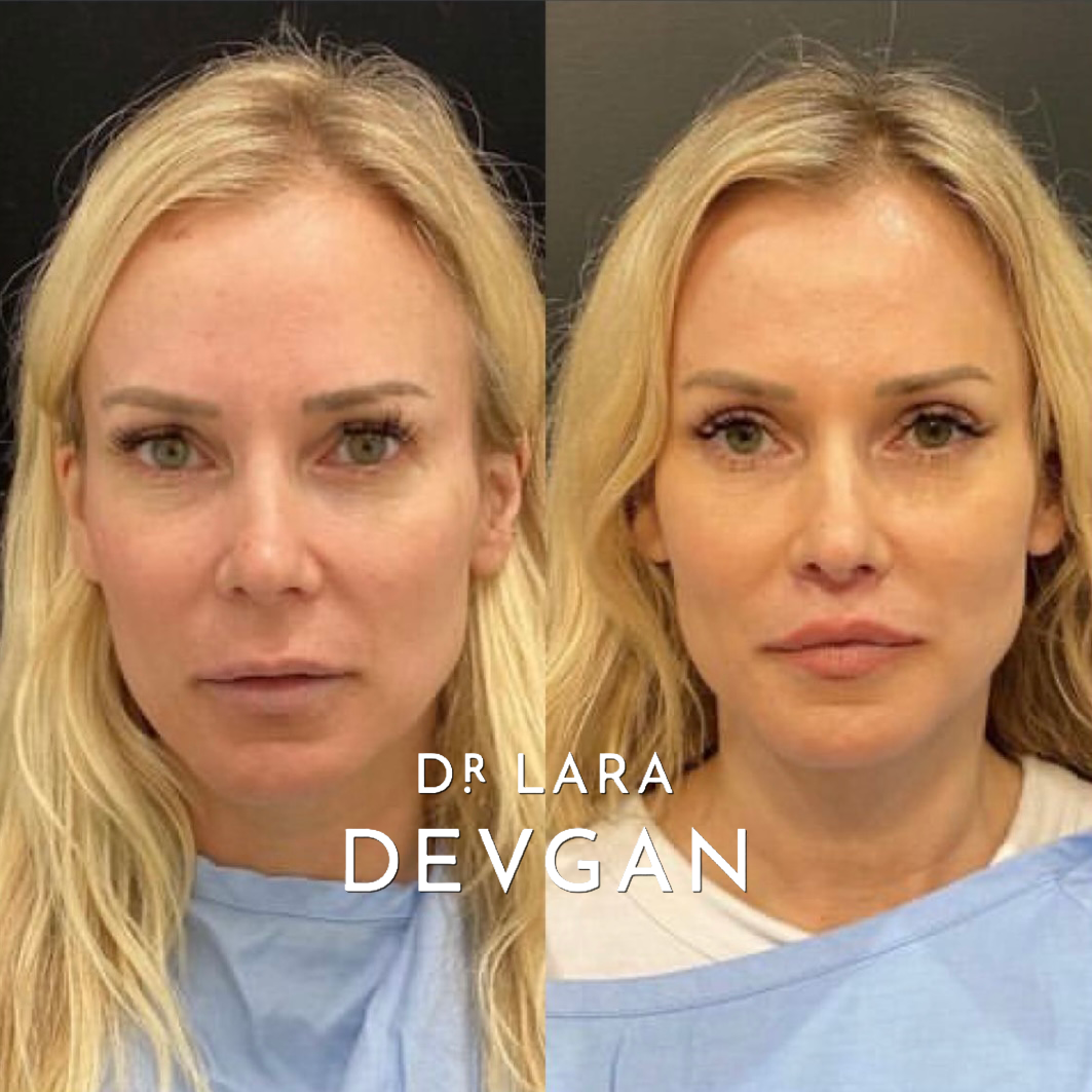 Devgan_SP_B&A_FavoriteCases_WM_Photo35_1.0.png