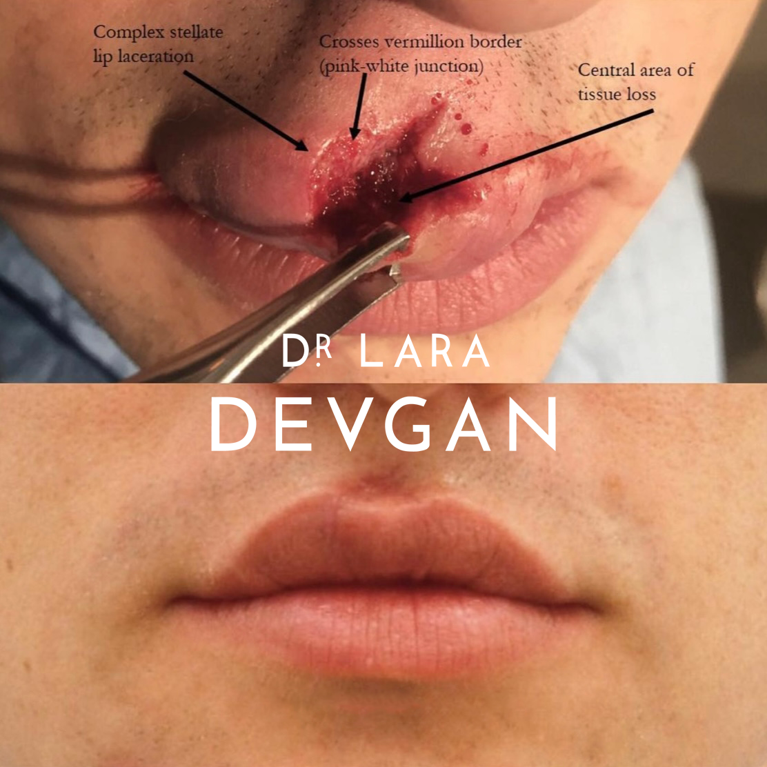 Devgan_10-21-2025_B&A_ReconstructiveSurgery_1_1.0.png