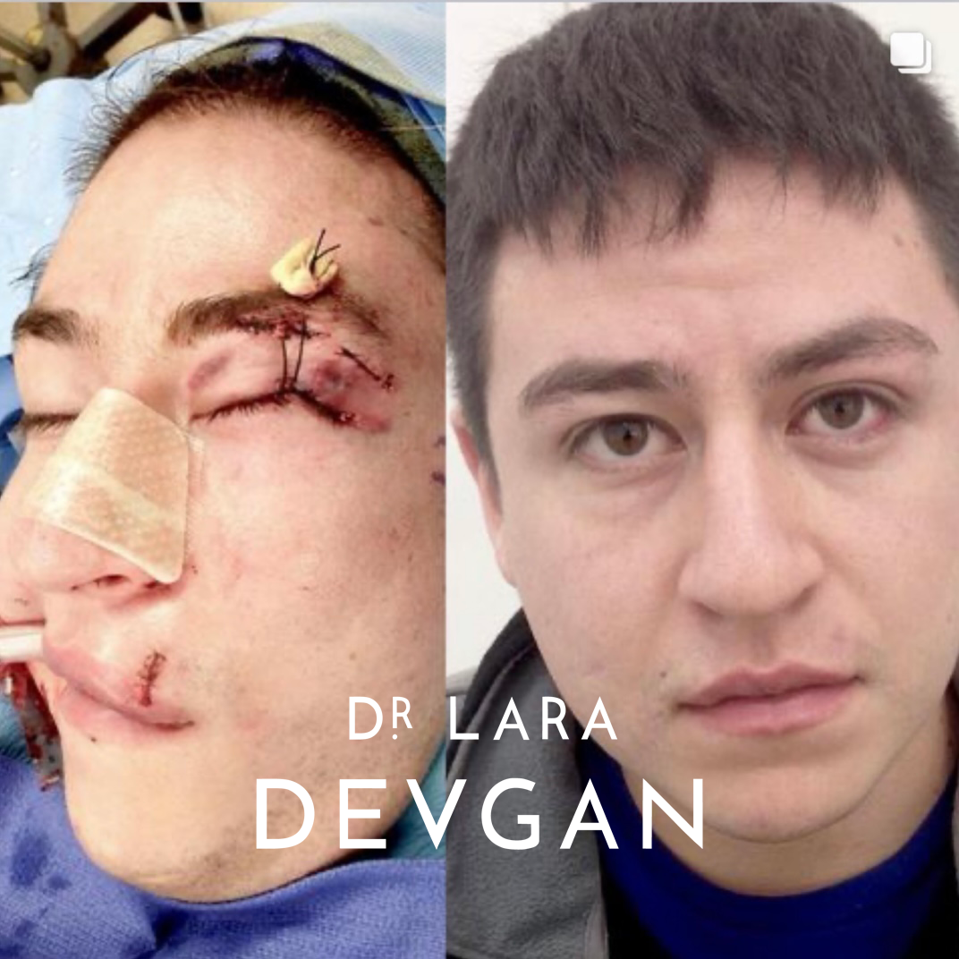 Devgan_10-21-2025_B&A_ReconstructiveSurgery_5_1.0.png
