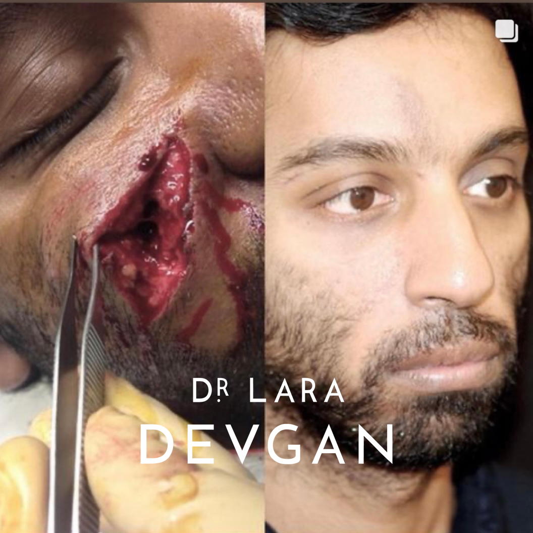 Devgan_10-21-2025_B&A_ReconstructiveSurgery_6_1.0.png