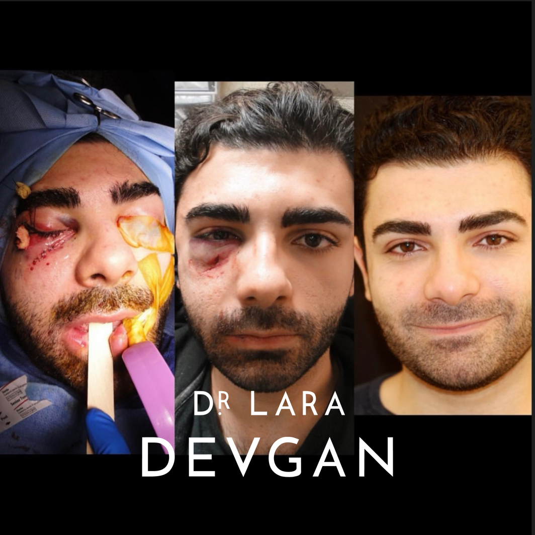 Devgan_10-21-2025_B&A_ReconstructiveSurgery_7_1.0.png