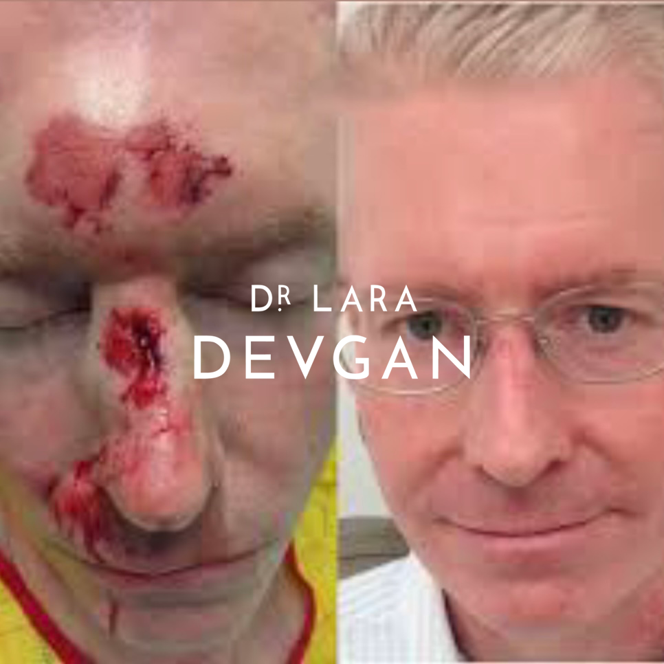 Devgan_10-21-2025_B&A_ReconstructiveSurgery_9_1.0.png