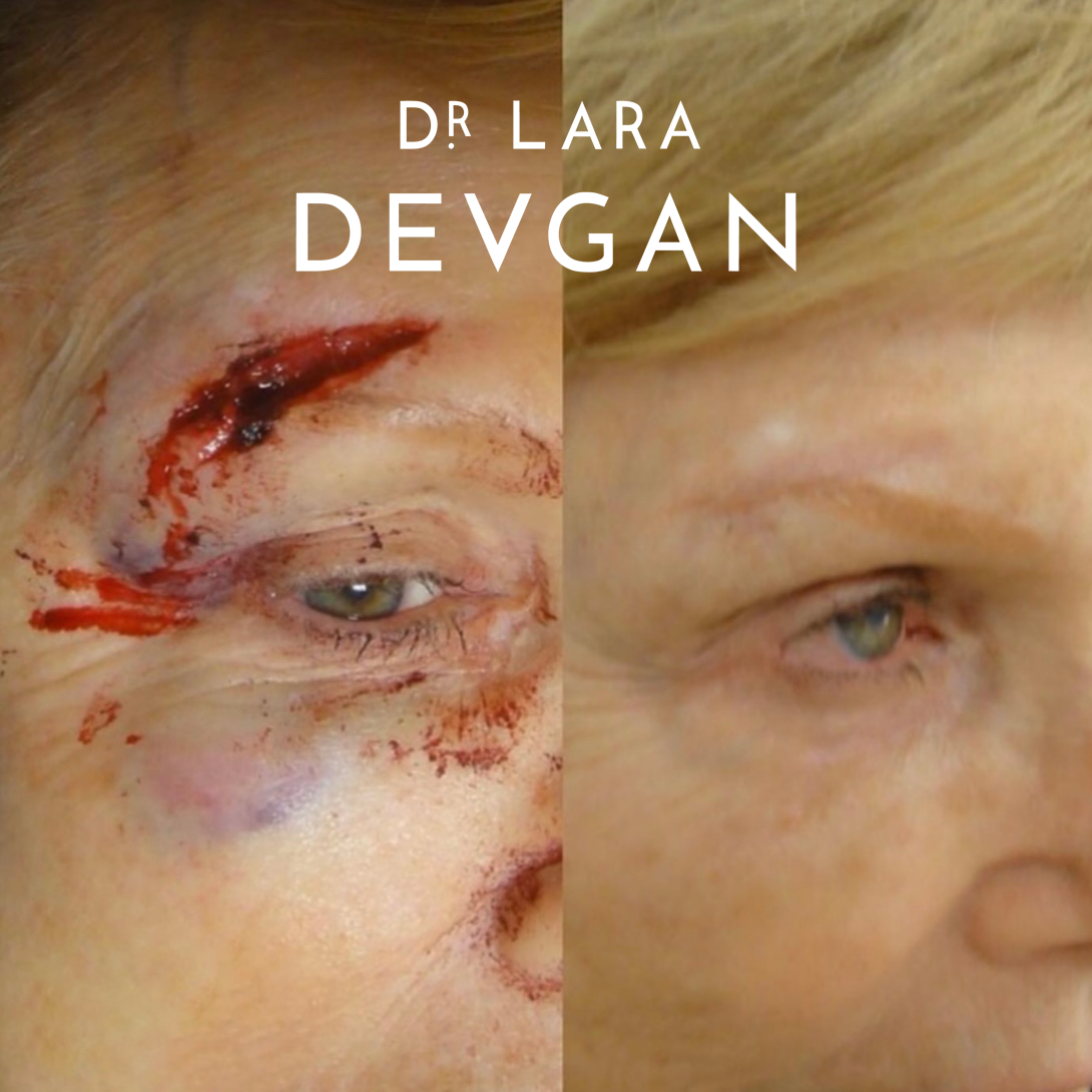 Devgan_10-21-2025_B&A_ReconstructiveSurgery_11_1.0.png