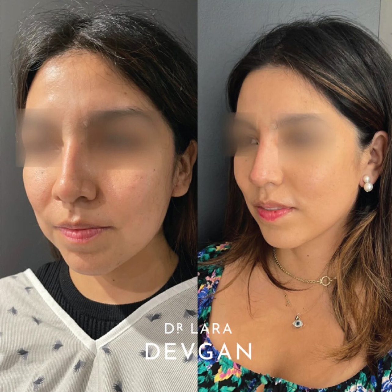 Devgan_SP_B&A_BFP_WM_Photo23_1.0.png