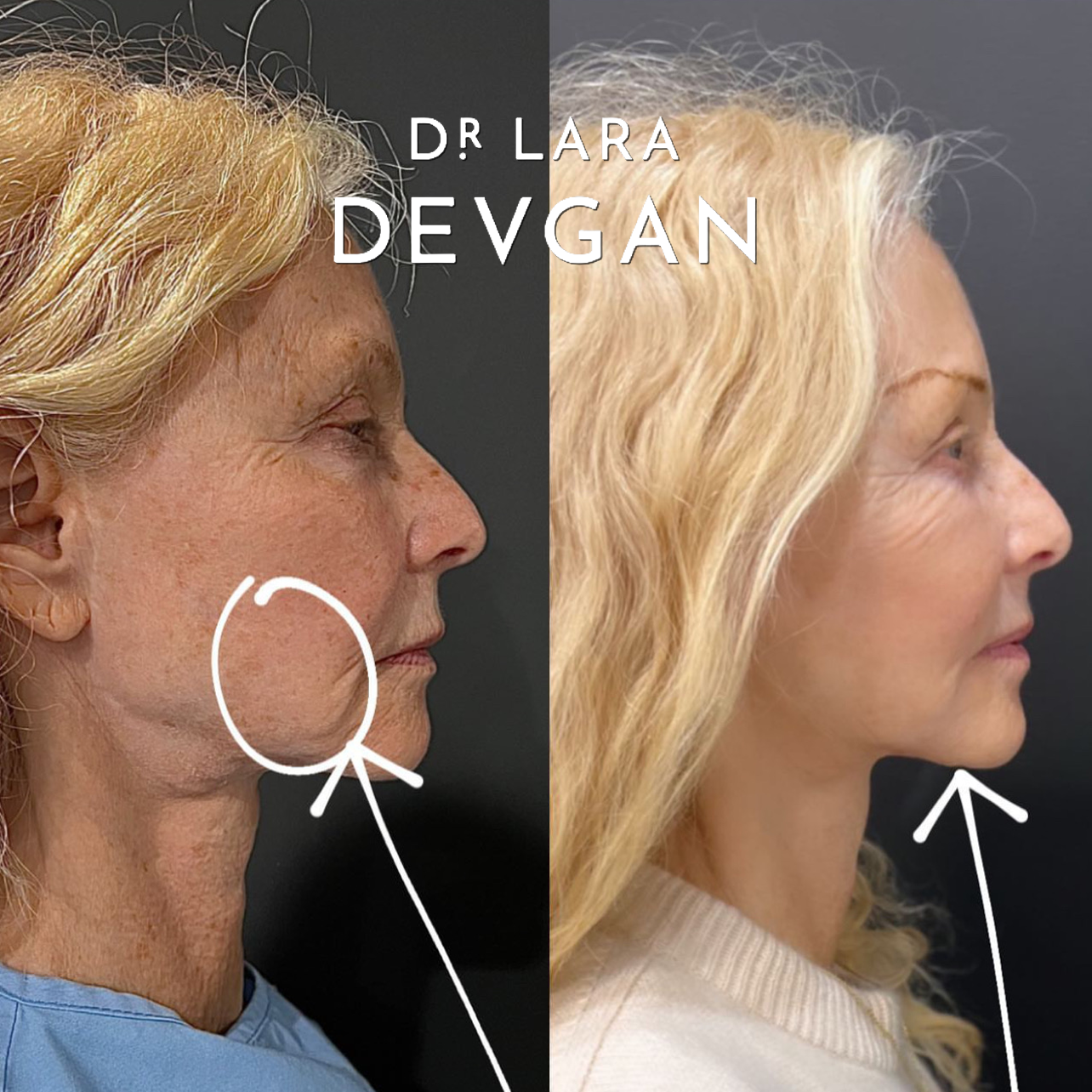 Devgan_SP_B&A_BFP_WM_Photo22_1.0.png