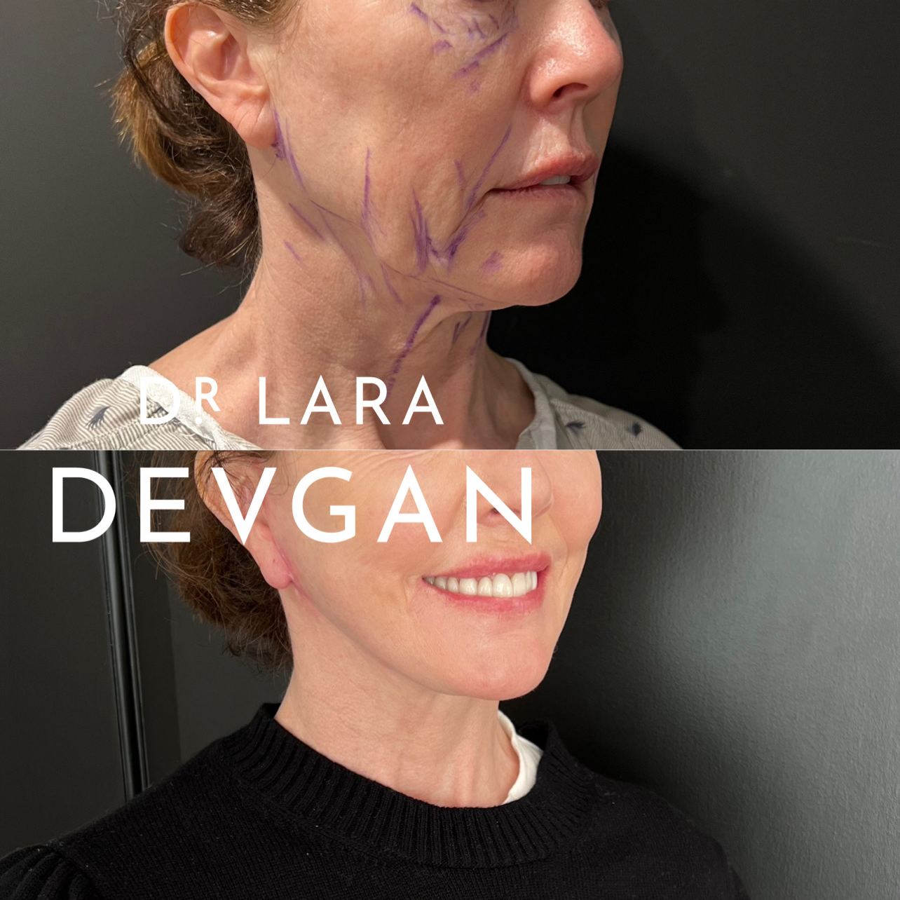 Devgan_SP_B&A_BFP_WM_Photo21_1.0.png
