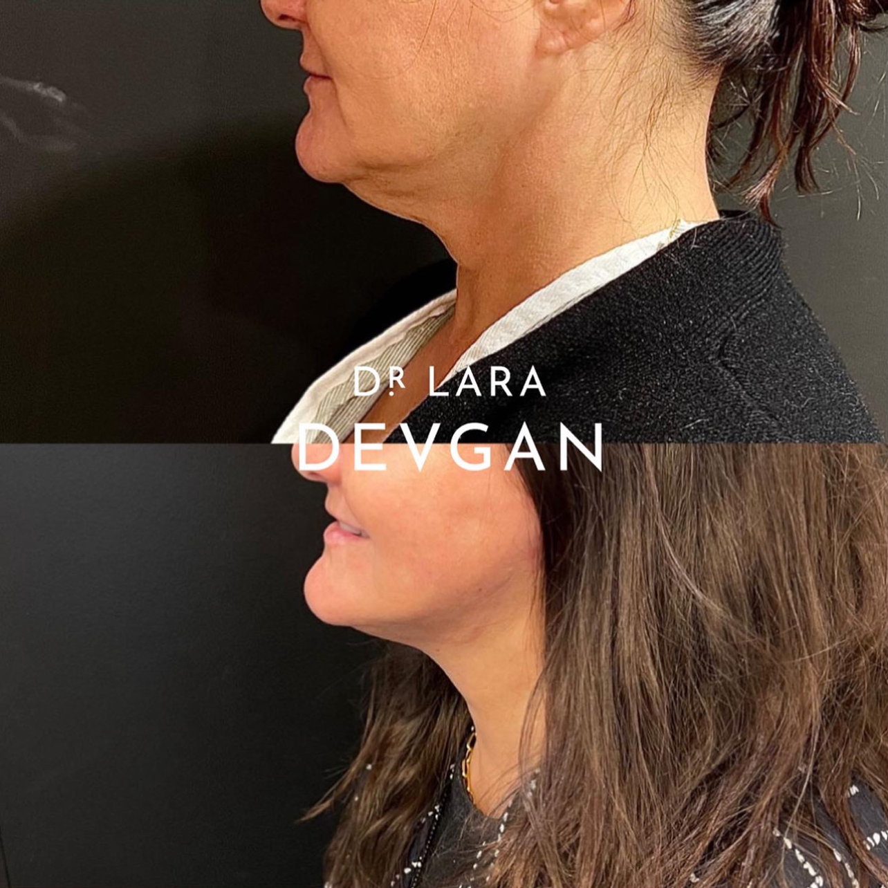 Devgan_SP_B&A_BFP_WM_Photo19_1.0.png