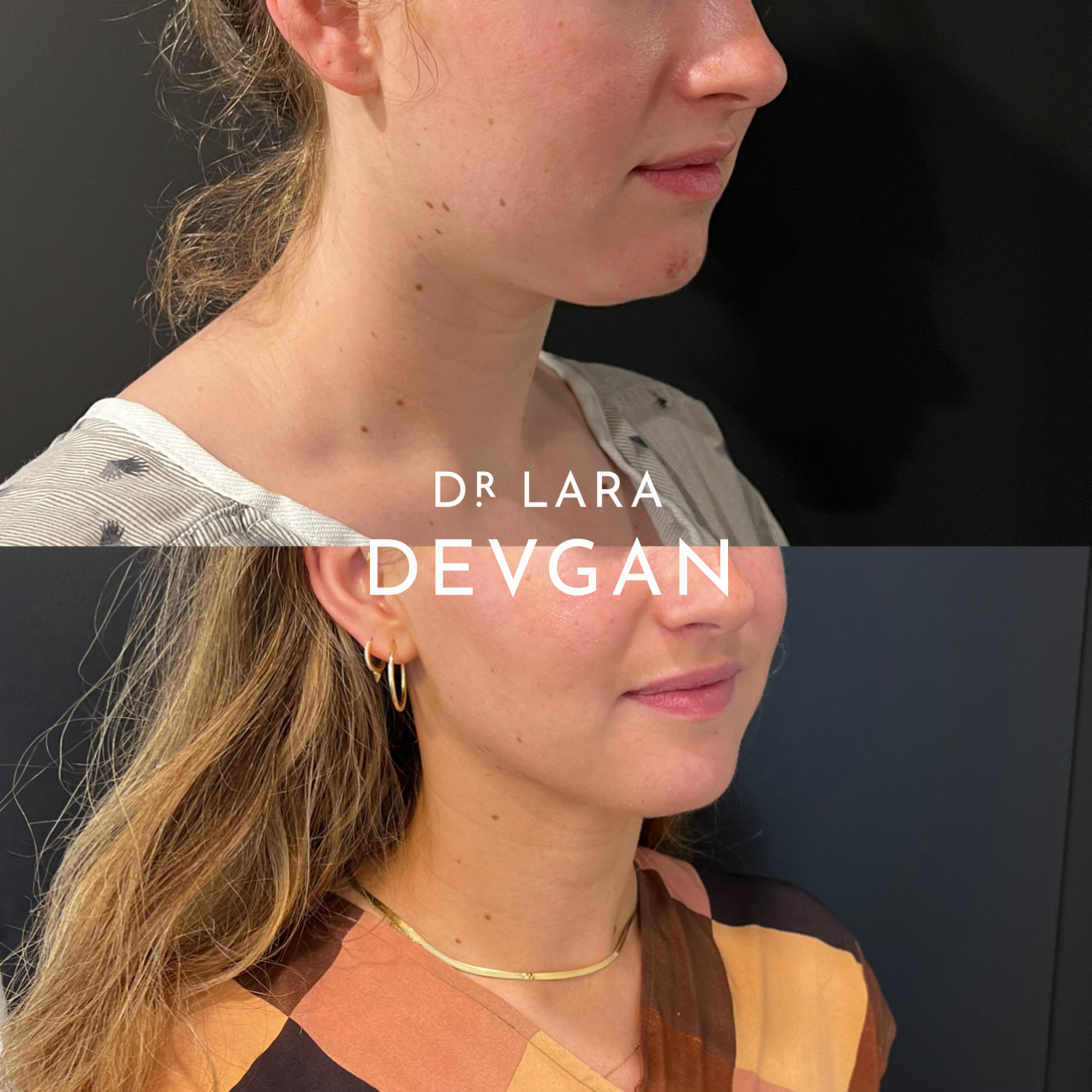 Devgan_SP_B&A_BFP_WM_Photo18_1.0.png