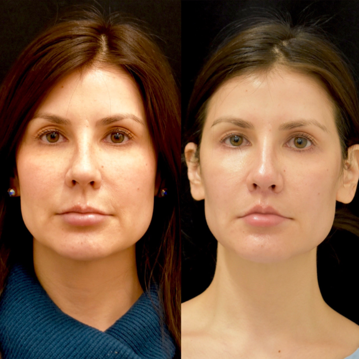 Devgan_SP_B&A_BFP_WM_Photo16_1.0.png