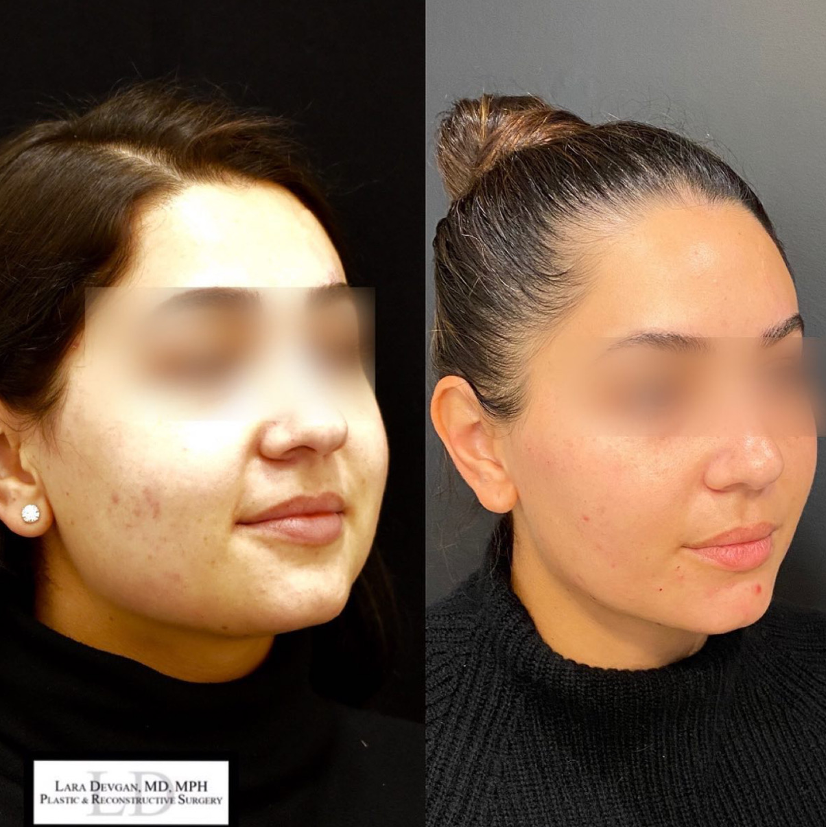 Devgan_SP_B&A_BFP_WM_Photo13_1.0.png