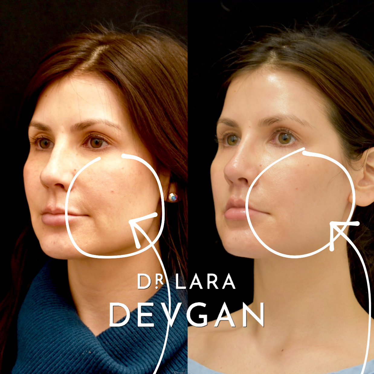 Devgan_SP_B&A_BFP_WM_Photo14_1.0.png