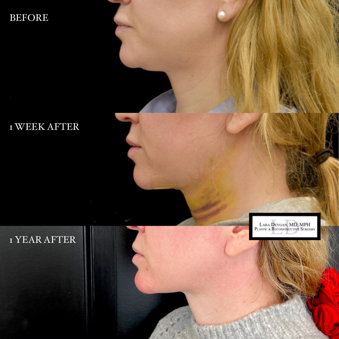 Devgan_SP_B&A_BFP_WM_Photo12_1.0.png