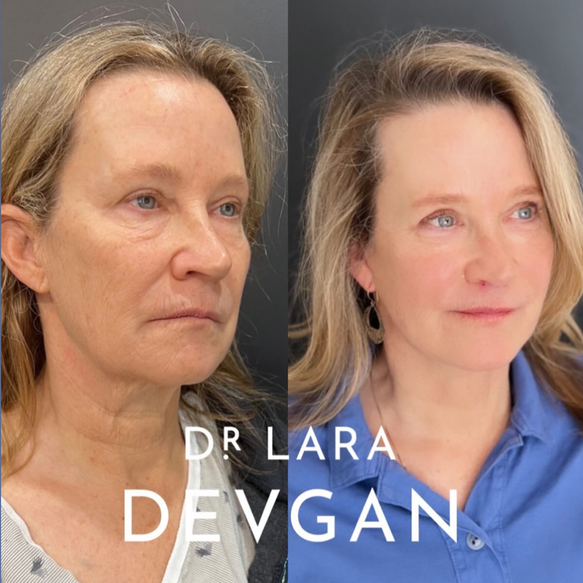 Devgan_SP_B&A_BFP_WM_Photo11_1.0.png