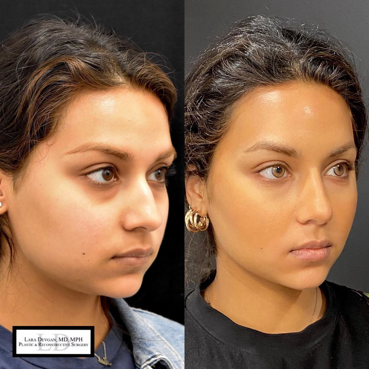 Devgan_SP_B&A_BFP_WM_Photo8_1.0.png