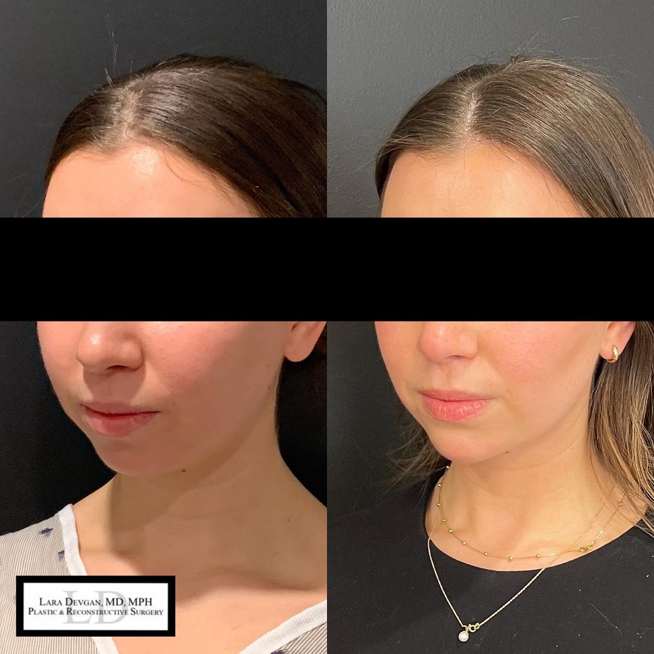 Devgan_SP_B&A_BFP_WM_Photo5_1.0.png