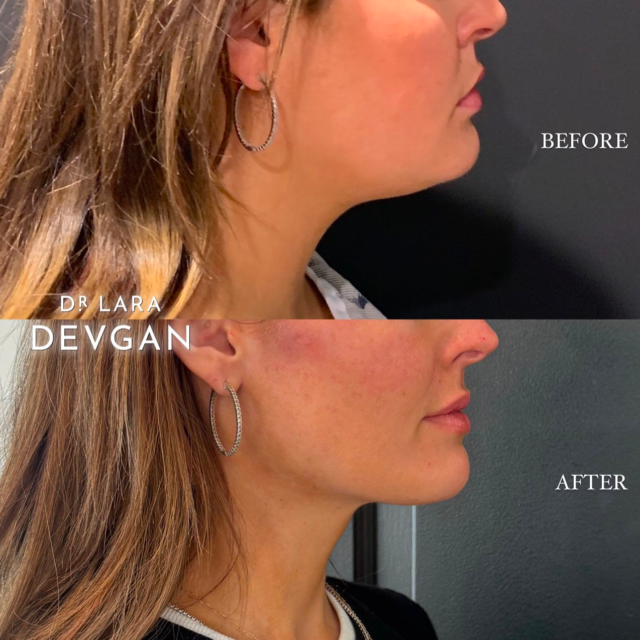 Devgan_SP_B&A_BFP_WM_Photo4_1.0.png
