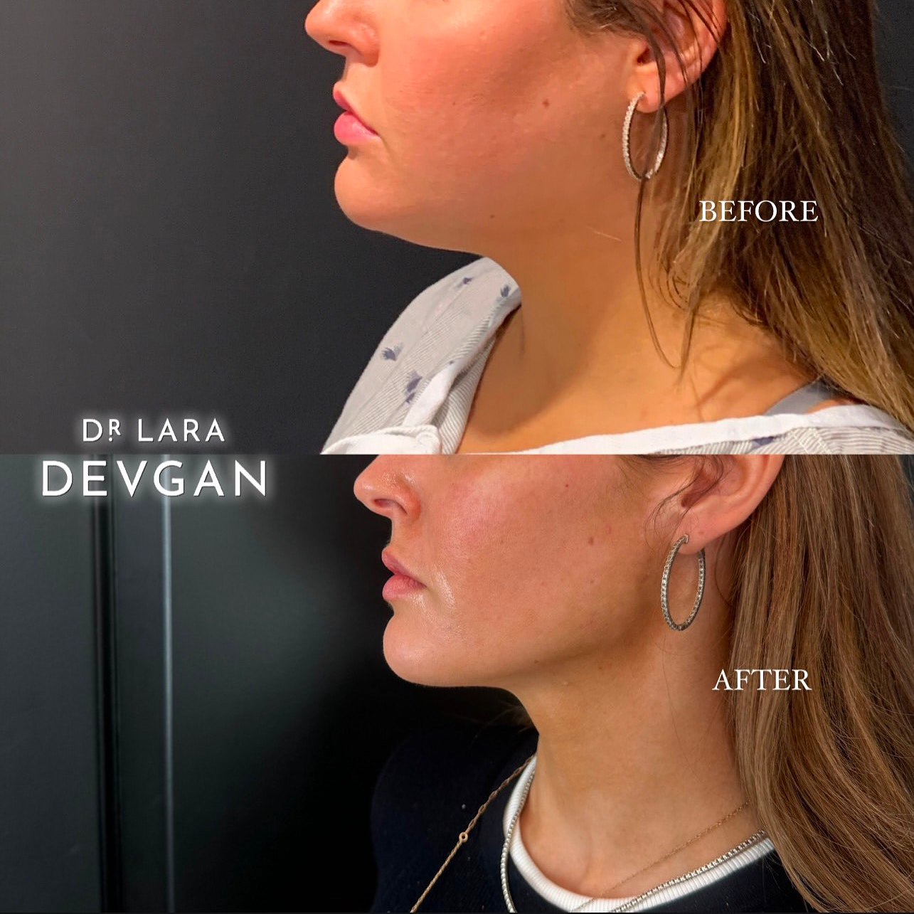 Devgan_SP_B&A_BFP_WM_Photo3_1.0.png