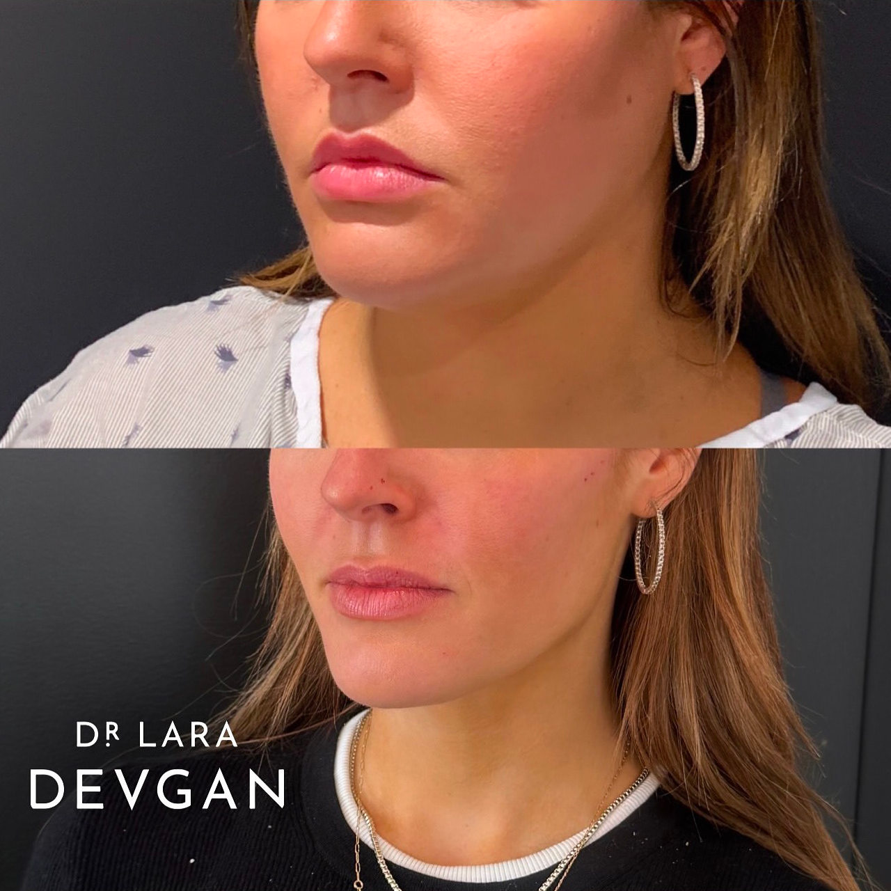 Devgan_SP_B&A_BFP_WM_Photo2_1.0.png
