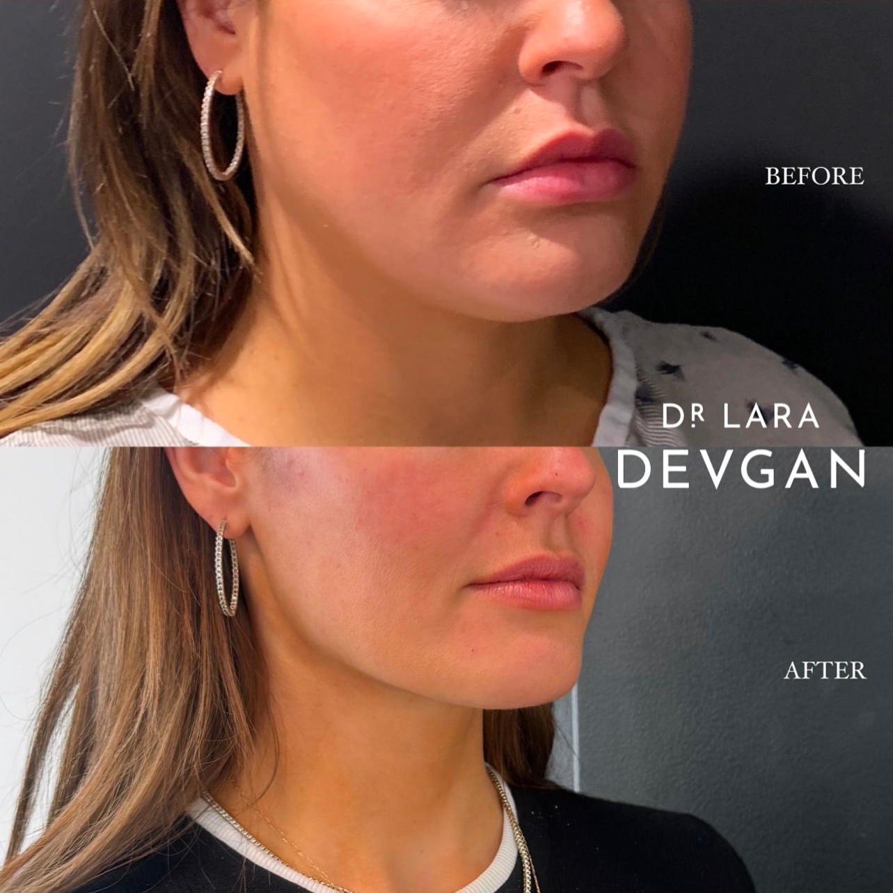 Devgan_SP_B&A_BFP_WM_Photo1_1.0.png