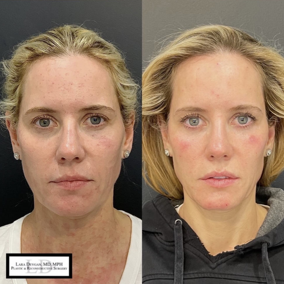 Facial plastic surgery NYC