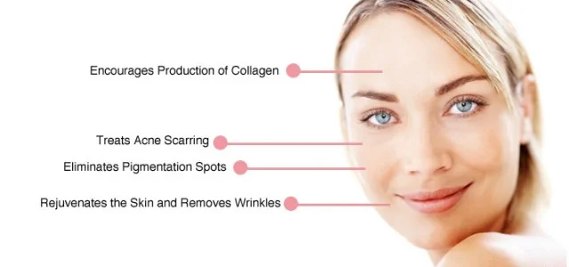 microneedling-Austin-640x300.jpg