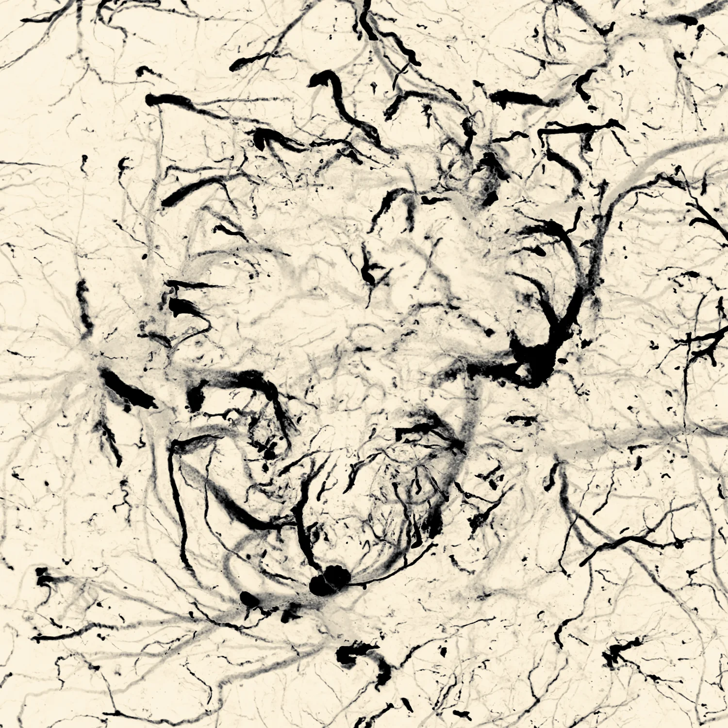 Moments Meant To Pass IV , 40 x 40 cm inkjet on canvas. Microglia surrounding an amyloid plaque. Captured for Jürgen Götz lab for their 2015 publication in Translational Medicine for ultrasound treatment of Alzheimer’s disease.
